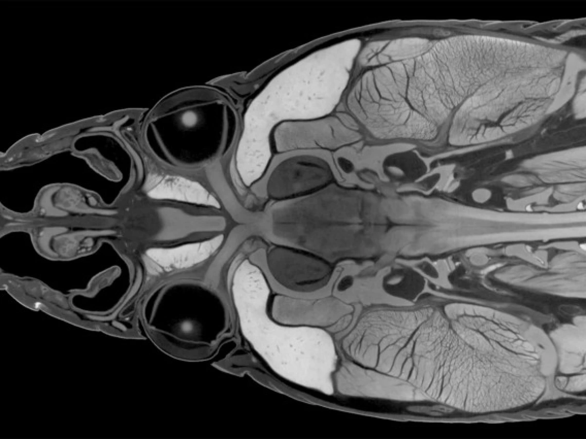 A black, white and grey image of a CT scan